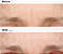 The Ordinary  Retinal 0.2% Emulsion Serum - Imagem 2