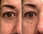 Biossance  Mini Squalane + Marine Algae Eye Cream for Fine Lines & Dark Circles - Imagem 2