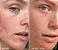 First Aid Beauty  Ultra Repair® Cream Intense Hydration – Face and Body Moisturizer for Skin Repair - Imagem 5