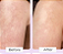 First Aid Beauty  KP Bump Eraser Body Scrub with 10% AHA – Body Exfoliant for Keratosis Pilaris - Imagem 5