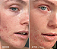 First Aid Beauty  Mini Ultra Repair® Cream Intense Hydration – Face and Body Moisturizer for Skin Repair - Imagem 2