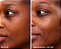 First Aid Beauty  Hydrating Dewy Gel Cream Moisturizer with Hyaluronic Acid + Ceramides - Imagem 2