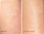 First Aid Beauty  After-Shower Nourishing Body Oil - Imagem 2