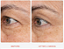 First Aid Beauty  Retinol Eye Cream with Squalane + Ceramides - Imagem 2