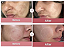 Medicube PDRN Pink Peptide Serum, Pink glow serum, Peptide, Niacinamide - Imagem 2