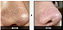 Medicube Zero Exosome Shot Mild 2,000 - Imagem 2