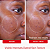First Aid Beauty Acne Clearing Pads - 2% Salicylic Acid Acne Treatment - Imagem 2