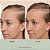 Vegamour 0.25 mm GRO+ Advanced Scalp Dermaroller - Imagem 4