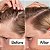 Act+Acre Salicylic Acid Scalp Renew Exfoliator For Oily + Flakey Scalp - Imagem 3