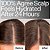 Act+Acre Daily Hydro™ Scalp Serum with Hyaluronic Acid for Dry Scalp - Imagem 2