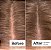 Act+Acre Microbiome Cooling Scalp Serum For Dry Itchy Scalp + Loose Flakes - Imagem 2