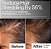 Act+Acre Scalp Discovery Set - Imagem 2