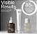 Act+Acre Scalp Relief System for Dandruff + Psoriasis + Eczema Gift Set - Imagem 3