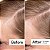 Act+Acre Thick + Full Hair Capsules for Fuller-Looking Hair - Imagem 3