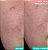 AESTURA A-CICA365 Soothing Repair Gel Cream Moisturizer pH4.5 with Centella Asiatica + Panthenol for Redness - Imagem 2
