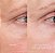 Hourglass Equilibrium Resurfacing Retinoid Treatment - Imagem 3