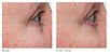 Kate Somerville Retinol Firming Eye Cream - Imagem 2