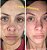 Admire My Skin Dark Spot Corrector Remover for Face - Imagem 3