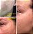 Admire My Skin Dark Spot Corrector Remover for Face - Imagem 6