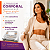 Sonopulse 1 e 3MHZ Portátil + Gel Condutivo 1kg - Ibramed - Imagem 2