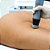 Equipamento Thork Ondas De Choque Com 1 Aplicador - Ibramed - Imagem 8
