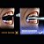 Fotopolimerizador Emitter Now Black Sem fio Multiwave - Schuster - Imagem 2