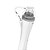 Needle RF Equipamento de Radiofrequência Microagulhada - HTM - Imagem 5
