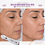 Plasmed Caneta de Jato de Plasma Portátil - IBramed - Imagem 6