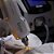 Ômer Smart Laser De Despigmentação Tatuagem e Micropigmentação - Medical San - Imagem 7