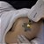 Ômer Smart Laser De Despigmentação Tatuagem e Micropigmentação - Medical San - Imagem 5