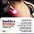 Endophoton Lite 660 Laser De Baixa Intensidade Sem Fio - Kld Biosistemas - Imagem 7