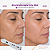 Plasmed Caneta de Jato de Plasma Portátil - IBramed - Imagem 6