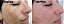 Renover Gomage Esfoliante AKMOS - Imagem 7