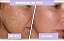 Renover Gomage Esfoliante AKMOS - Imagem 8