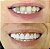 Dentadura Universal Superior + Inferior de Silicone Encaixa Facil Na Boca, Calcular o Frete> - Imagem 7