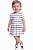 Vestido Bebe Tommy Hilfiger listrado - Imagem 2