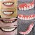 Sorriso Perfeito Com Smile Dentes Postiço - Imagem 2