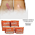 Fita Cirúrgica de Silicone Hipoalergênica - Unidade - Vital Derme - Imagem 8