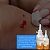 Polihexam Gel para Limpeza de Feridas Solugel - Helianto - Imagem 5