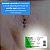 Fio de Sutura Monofilamento Nylon com Agulha - Unidade - Procare - Imagem 7