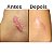 Fita Cirúrgica de Silicone Hipoalergênica - Skinupper - Imagem 6