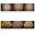 Curativo Stratamark 20g - Stratpharma - Imagem 4