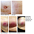 Curativo Stratamed 10g - Stratpharma - Imagem 4