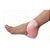 Curativo ALLEVYN Gentle Border Heel Smith & Nephew - Imagem 7