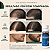 Minoxidil Kirkland Original 5% Onde Comprar - Imagem 5