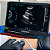 Ultrassom Portátil com Dupla Cabeça – Wi-Fi/USB e Doppler - Sdorf - Imagem 3