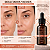 Sérum Facial PDRN e Exossomos Korean Perfect Anjore 30ml Firmeza Colágeno Linhas e Rejuvenescimento - Imagem 1