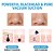 Blackhead Remover Cara Limpa Poros a Vacuum Acne Pimple Vácuo - Imagem 6