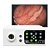 VIDEOPROCESSADORA PARA ENDOSCOPIA - Imagem 2