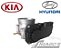 Corpo de borboleta - TBI Kia Sportage / Hyundai Elantra / IX35 2.0 - 35100-2E300 - Imagem 3